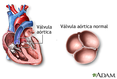 válvula aórtica